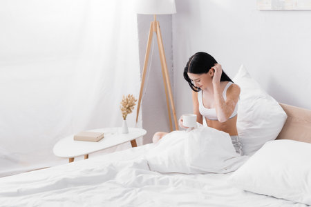 smiling woman with vitiligo holding cup of coffee while fixing hair in bedの写真素材