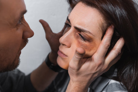 Aggressive man touching face of wife with bruisesの写真素材