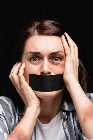 Portrait of woman with bruises and adhesive tape on mouth isolated on blackの写真素材