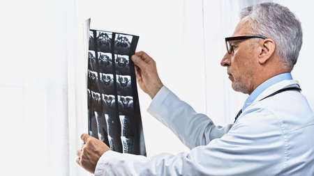 doctor in white coat and eyeglasses looking at x-ray near window in clinic