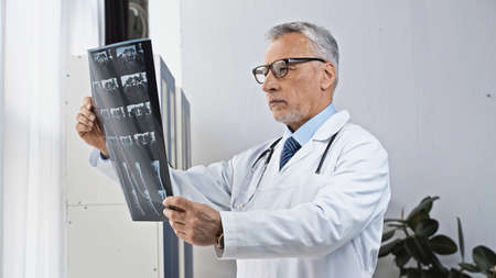 mature doctor in eyeglasses looking at x-ray in hospitalの写真素材