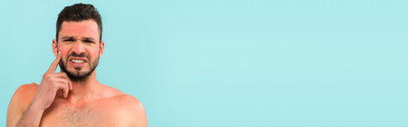 Worried shirtless man with sunburn looking at camera isolated on blue, bannerの写真素材