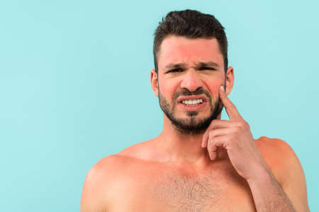 Young shirtless man with sunburn looking at camera isolated on blueの写真素材