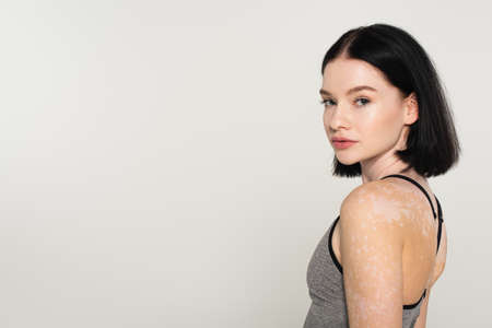Young sportswoman with vitiligo looking at camera isolated on grayの写真素材