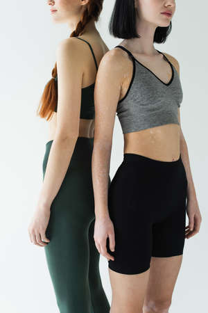 Cropped view of sportswomen with vitiligo and freckles standing back to back isolated on gray