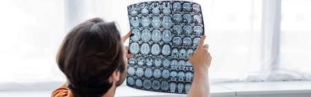 man looking at mri scan against window at home, banner