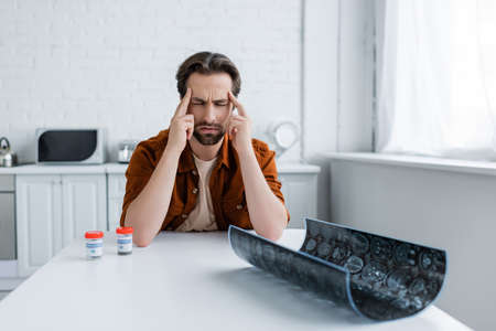 man suffering from headache near containers with medical cannabis and mri scanの写真素材