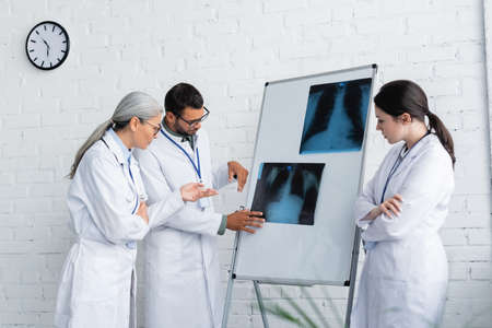 middle aged asian doctor pointing at lungs fluorography near young physicians