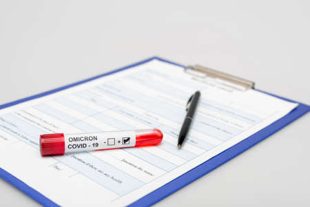 clipboard with medical card,  variant test tube and pen on gray background