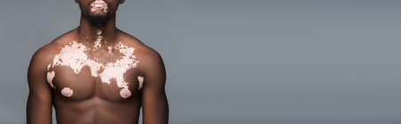 cropped view of shirtless african american man with vitiligo skin and muscular torso  isolated on...