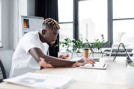 concentrated african american man with vitiligo holding smartphone while typing on laptop in office