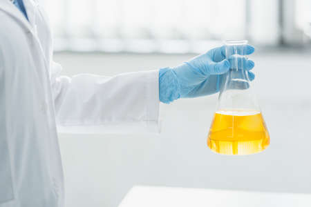 cropped view of woman in latex glove holding flask with yellow liquid