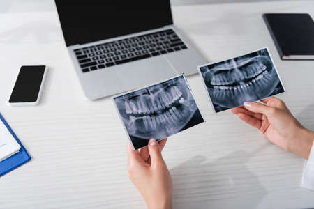 Cropped view of doctor holding scans of teeth near blurred devices in clinic