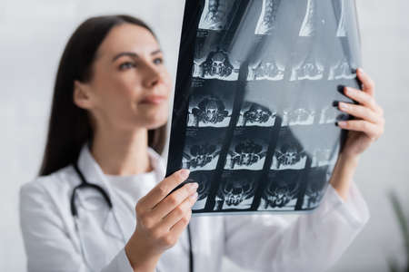Mri scan in hands of blurred doctor in clinicの写真素材