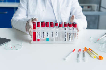 Cropped view of scientist holding test tubes with monkeypox lettering near syringes in labの写真素材