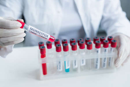 Cropped view of blurred scientist holding test tube with monkeypox lettering in lab