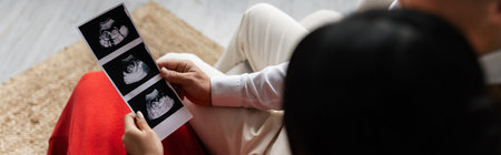 overhead view of couple holding ultrasound scan with pregnancy confirmation on blurred foreground,...