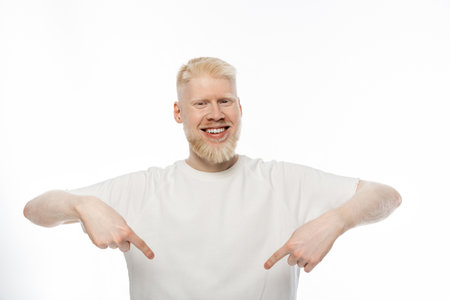 cheerful albino man in t-shirt pointing down with fingers on white backgroundの写真素材