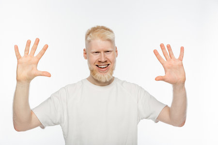 cheerful albino man in t-shirt waving hands isolated on whiteの写真素材