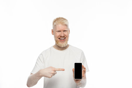 happy albino man in t-shirt pointing at smartphone with blank screen isolated on whiteの写真素材