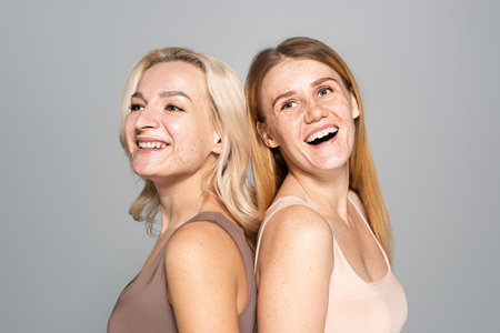 Cheerful women with skin issues standing back to back isolated on greyの写真素材