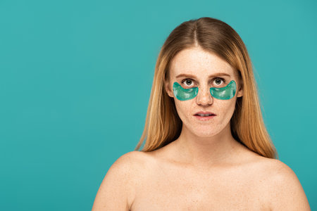 redhead woman with freckles and patches under eyes looking at camera isolated on turquoise