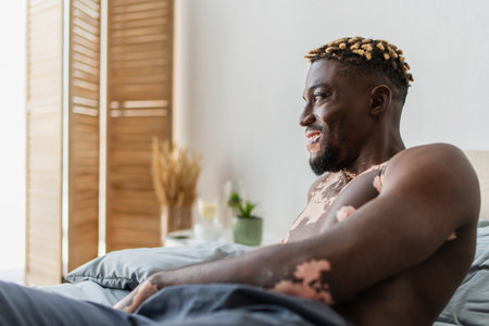 Side view of positive and shirtless african american man with vitiligo lying on bed at homeの写真素材