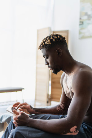 Side view of shirtless african american man with vitiligo using digital tablet while sitting on bed at homeの写真素材