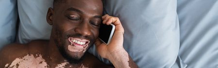 Top view of positive african american man with vitiligo talking on mobile phone on bed, banner