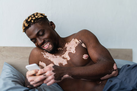 Shirtless african american man with vitiligo using smartphone and smiling in bedroomの写真素材