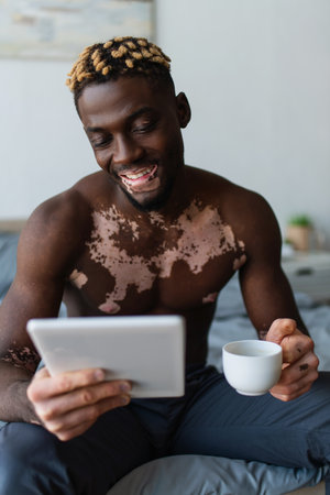 Smiling african american man with vitiligo using digital tablet and holding coffee cup in bedroomの写真素材