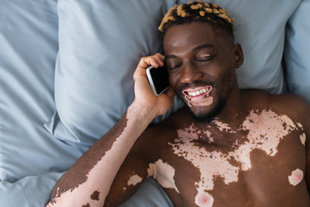 Top view of smiling and shirtless african american man with vitiligo talking on smartphone on bed