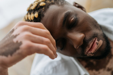 Portrait of african american man with vitiligo sitting in blurred bathtub at homeの写真素材