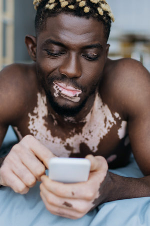 Skeptical african american man with vitiligo using blurred smartphone on bedの写真素材
