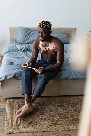 Shirtless african american man with vitiligo using digital tablet while sitting on bed at homeの写真素材