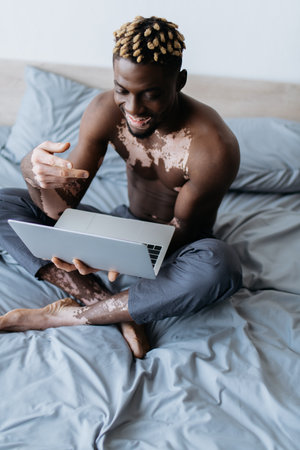 Smiling and shirtless african american man with vitiligo having video call on laptop on bedの写真素材