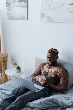 Smiling african american man with vitiligo holding coffee cup and using laptop on bedの写真素材