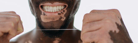 Cropped view of african american man with vitiligo smiling and holding dental floss at home, bannerの写真素材