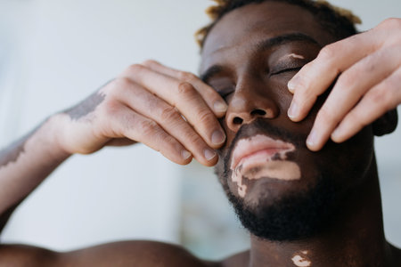 Portrait of young african american man with vitiligo touching face at home