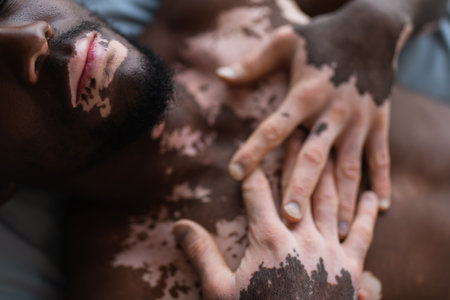 Top view of shirtless african american man with vitiligo lying on blurred bed at homeの写真素材