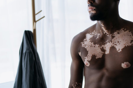 Cropped view of shirtless african american man with vitiligo standing near blurred floor hanger at homeの写真素材