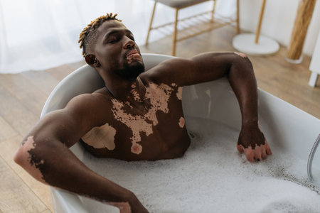 Young african american man with vitiligo relaxing in bathtub at homeの写真素材