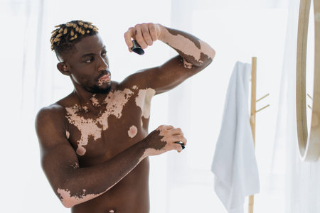 Shirtless african american man with vitiligo using deodorant near mirror in bathroomの写真素材
