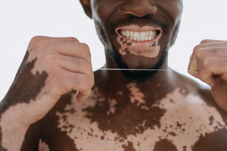 Cropped view of shirtless african american man with vitiligo holding dental floss at homeの写真素材