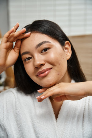 portrait of happy young asian woman with acne touching face and looking at camera, skin careの写真素材