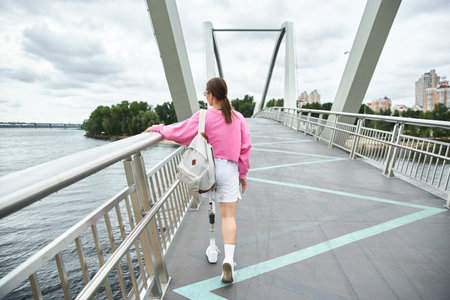 A determined young woman with a prosthetic leg walking on a picturesque bridge.の写真素材