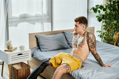 A thoughtful young man with a prosthetic leg sits on a bed, looking out into the light filled room.