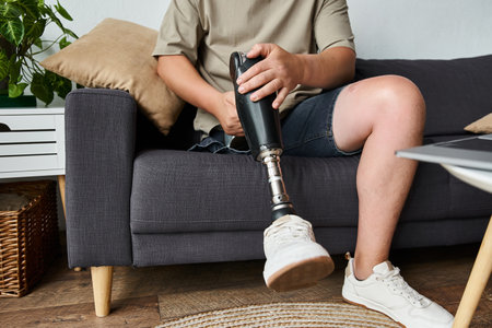 Handsome young man sits comfortably on a couch, focusing on his prosthetic leg.の写真素材