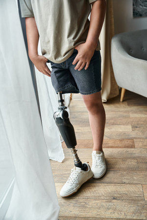 A young, attractive man stands confidently with his visible prosthetic leg in a modern living room.の写真素材