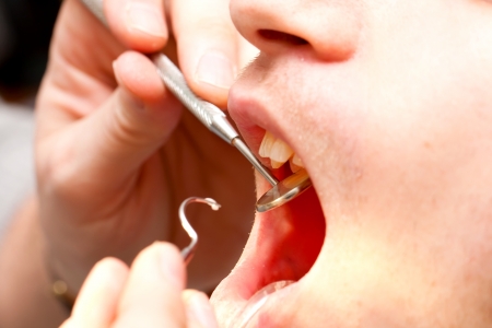 Dentist working with dental tools.の写真素材